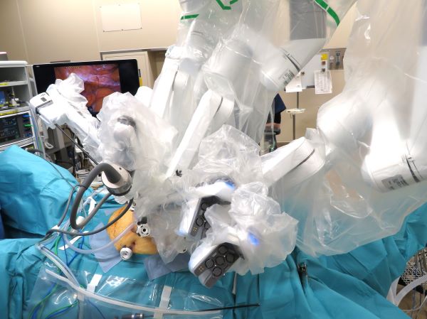 結腸がんに対してもロボット手術（daVinci）-2